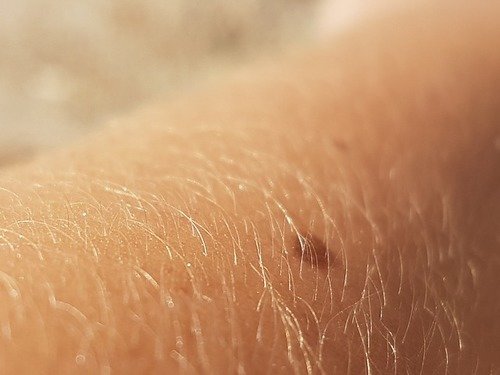 Dermatologie